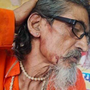 Hathras; लोकेश्वर महादेव मंदिर पर संत के साथ की मारपीट , लोगो में आक्रोश